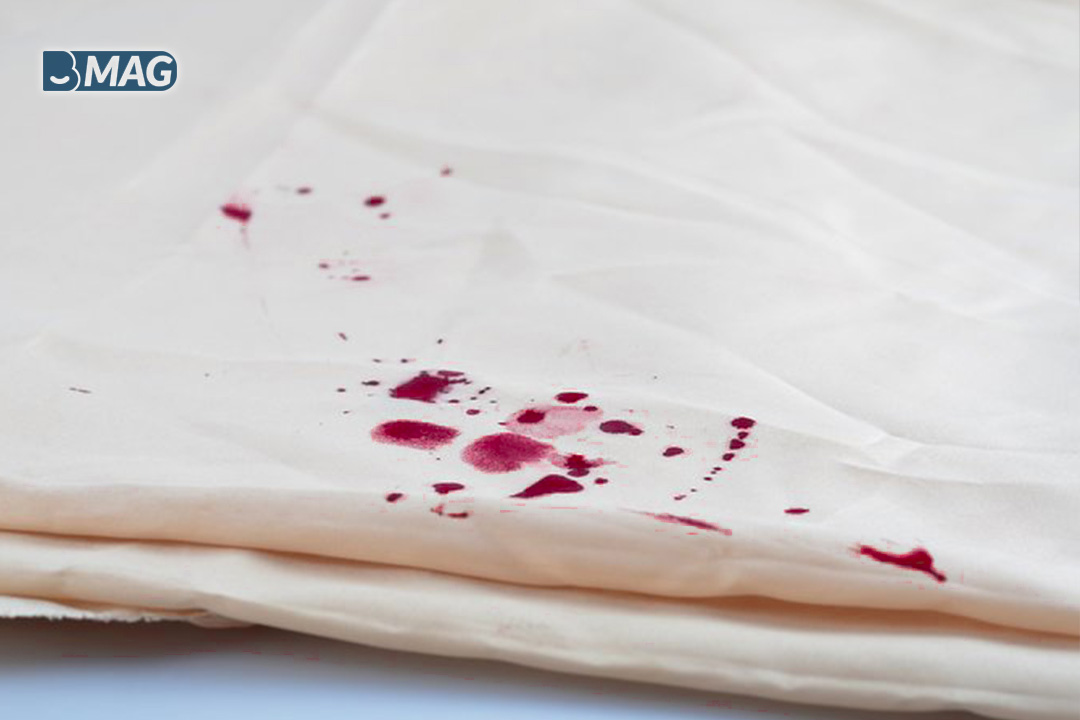 لکه خون روی لباس سفید